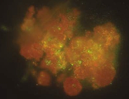 Fluoreszenzmikroskopie-Bilder zeigen die Zellschäden unter verschiedenen Bedingungen. Eine spezielle Färbung markiert die intakten Zellmembranen einer frei im Raum schwebenden Probe in grün. (Bild: ESA)